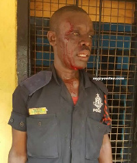 One of the police officers beaten by officers of the Ghana Armed Forces in Tamale