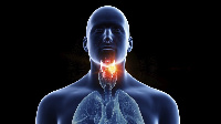 Throat cancer dey happun wen cells inside di throat develop genetic mutations