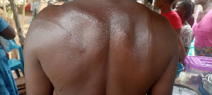 One of the victims of the assault shows marks he sustained