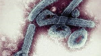 Marburg virus