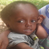 A physically challenged child living with  Louisa Enyonam Ansah