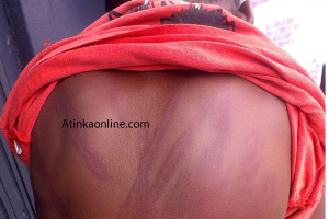 Atinka Student Beaten