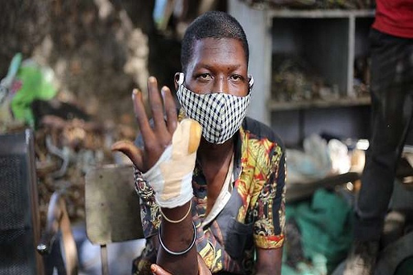 18-year-old Abubakar Sadiq had his finger severed for allegedly stealing a clock