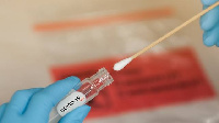 Coronavirus test kit