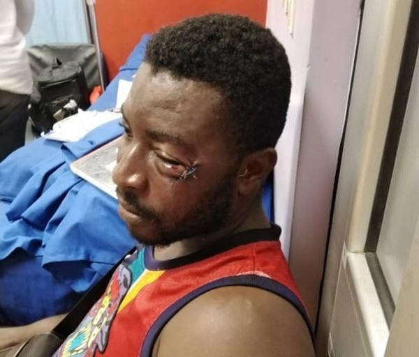 Michael Siaw was beaten by boxer Patrick Allotey