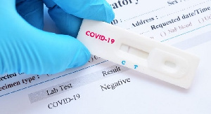 Covid Coronavirus File 09fk