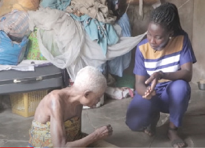 This old woman is among the people who go through hardship coupled with disability