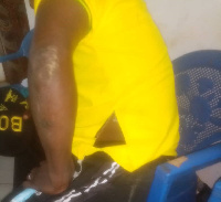 Ernest Thompson Quartey was beaten up by fans of Berekum Chelsea