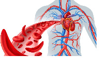 A depiction of sickle-cells