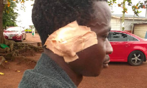 Emmanuel Agbeko with his plaster over his affected ear