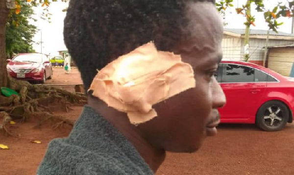 Emmanuel Agbeko with his plaster over his affected ear