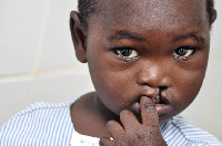 A child with cleft lips