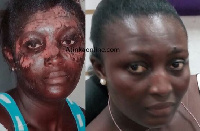 Doris Nyarko photos after horrible June 3 disaster (L)  and now (R)