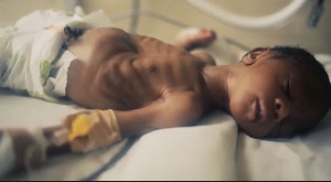 About 140,000 children are born premature in Ghana every year and over 8,000 die before 30 days