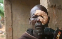 Mohammed lost his eye in a dog fight