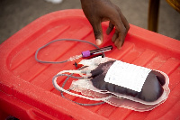 File photo of blood donation