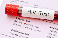 According to the NGO, attention on HIV/AIDS has now been shifted to coronavirus