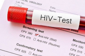 According to the NGO, attention on HIV/AIDS has now been shifted to coronavirus