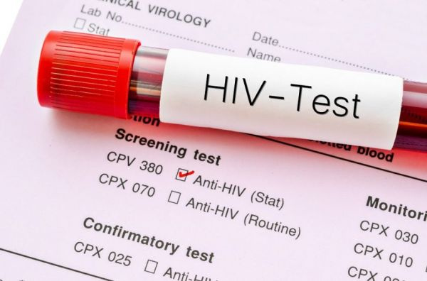 According to the NGO, attention on HIV/AIDS has now been shifted to coronavirus