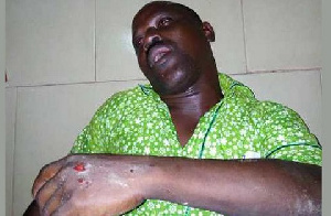 Jerry Azanduna was beaten by a gang of thugs allegedly hired by Hassan Ayariga