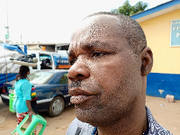 Rev Turkson managed to escape with a swollen face and bruises on his body