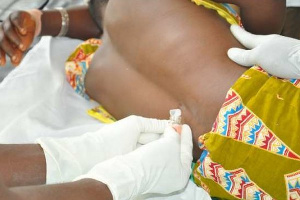 CSM kills tens of people annually especially in the Upper West Region