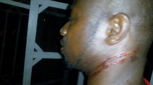 NPP Man Attacked By Macho2 Men