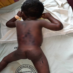 The three-year-old boy sustained deep wounds on his body