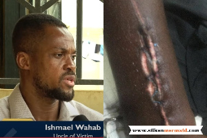 Ishmael Wahab describes the attack on his nephew as an attempted murder