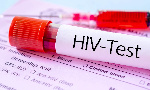 An HIV test kit