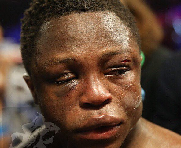 Isaac Dogboe until now had gone 20 fights without defeat