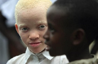 Albinism occurs when a person inherits two mutated or altered gene from the parent's sperm and egg