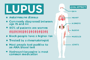 File Photo Lupus