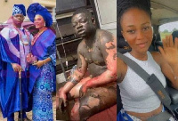 The man was burnt by his wife over alleged infidelity