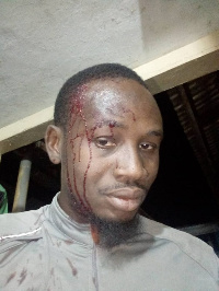 Mohammed Abdul Razak was slashed with a cutlass