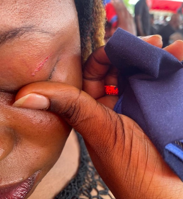 Dzifa Doris Kaledzi, who was attacked by the DCE, sustained a cut above her eyelid