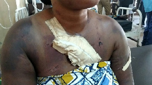 One of the alleged prostitutes attacked