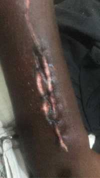 Ishmael suffered stab wounds on his arms and chest