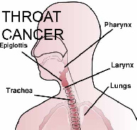 Smoking is the major cause of cancer cases across the globe