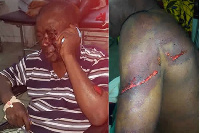 Nana Kwesi Agyeman IX was assaulted by an unknown gang