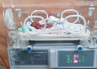 The incubators will go to support the care of pre-term babies across the country