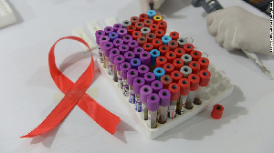 HIV1