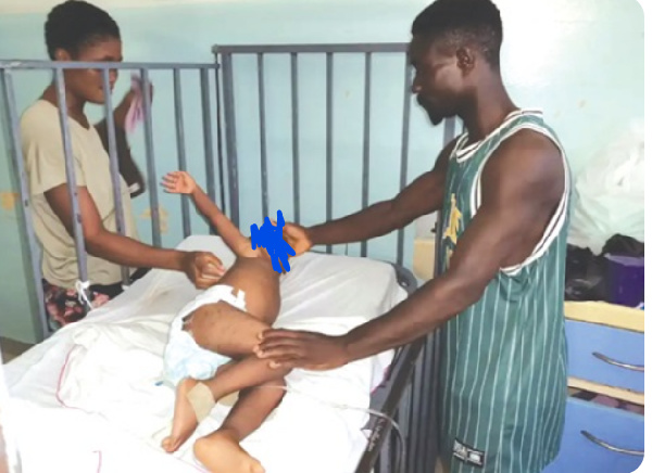 The two-year-old child underwent corrective surgery for injuries to his buttock