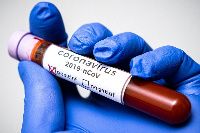 File Photo: The Upper East and West have recorded confirmed cases of Coronavirus