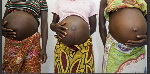 Maternal mortality refers to deaths due to complications from pregnancy or childbirth
