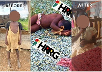 Mary Asana before and after her rescue