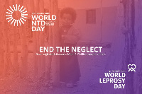 This year's celebration was on the theme: 'Face NTDs and End the Neglect'