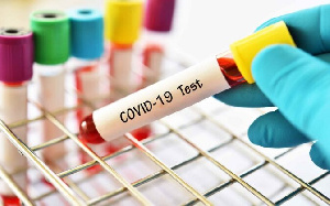 File photo - Blood samples for coronavirus test