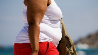 Obesity is a possible feature of having PCOS