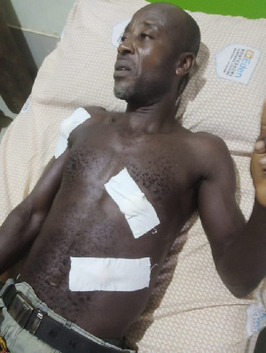 Samuel Bonney at the hospital